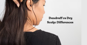 Dandruff vs Dry Scalp: Differences & Treatment