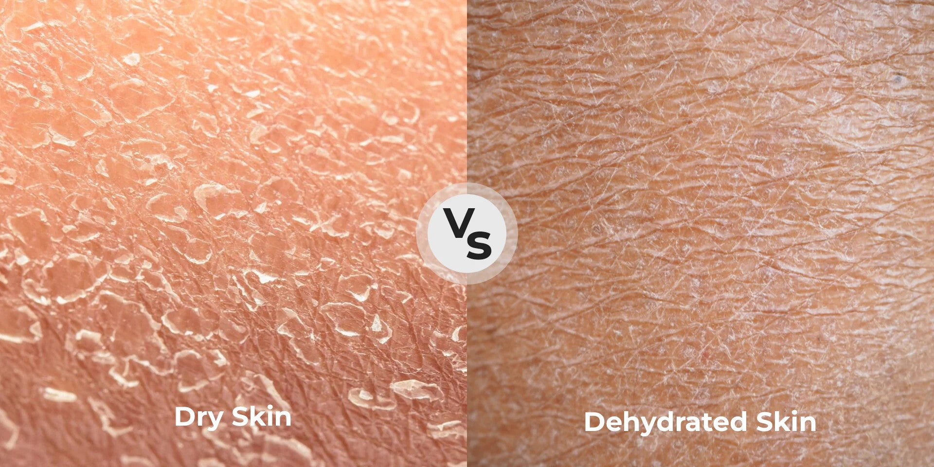 The Difference Between Dry And Dehydrated Skin