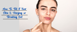How To Tell if Your Skin Is Purging or Breaking Out