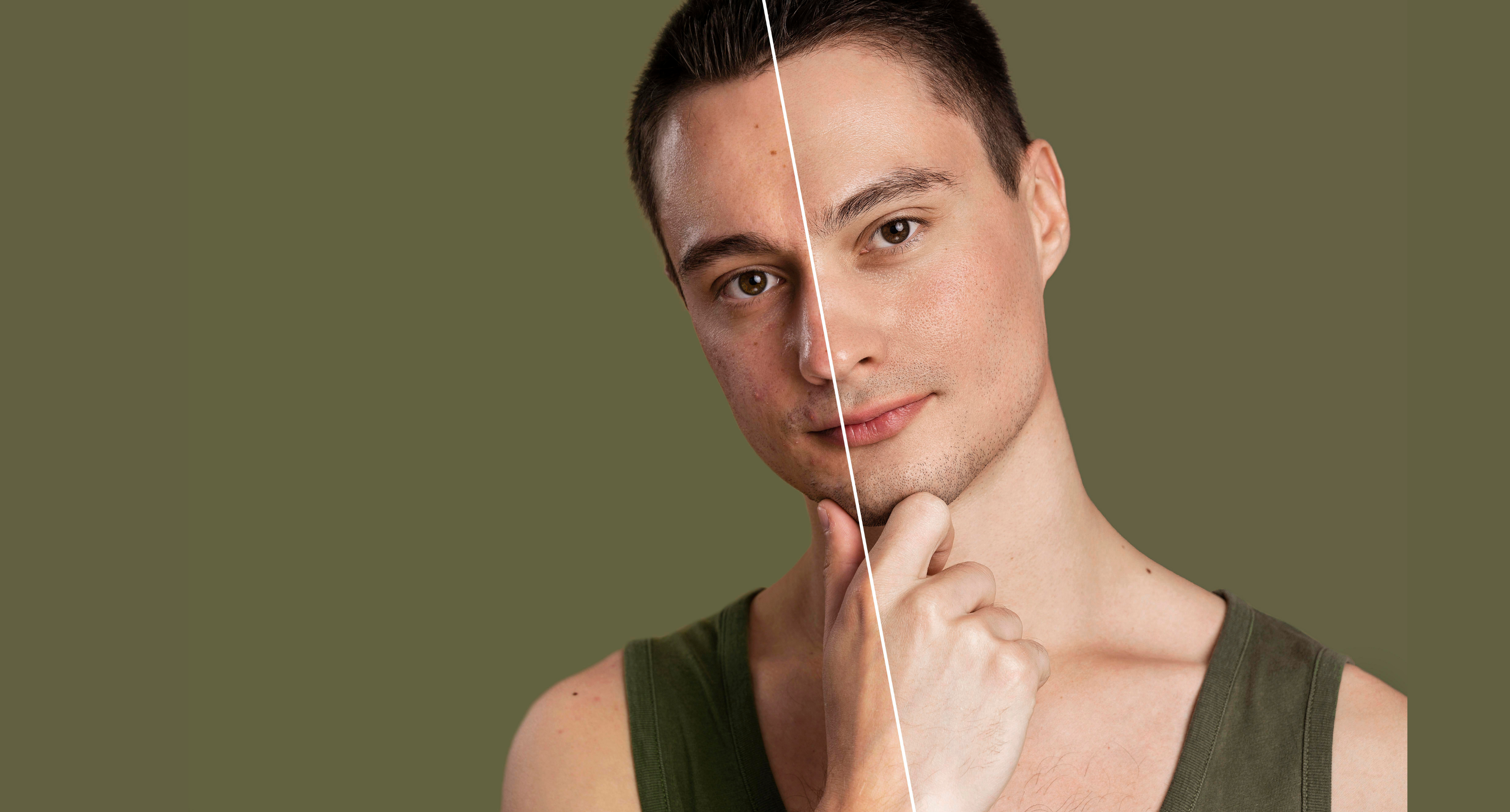 How To Reduce Melanin In Skin